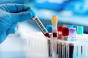 O melhor Curso de An&aacute;lise e Interpreta&ccedil;&atilde;o de Exames Laboratoriais para Nutricionistas
